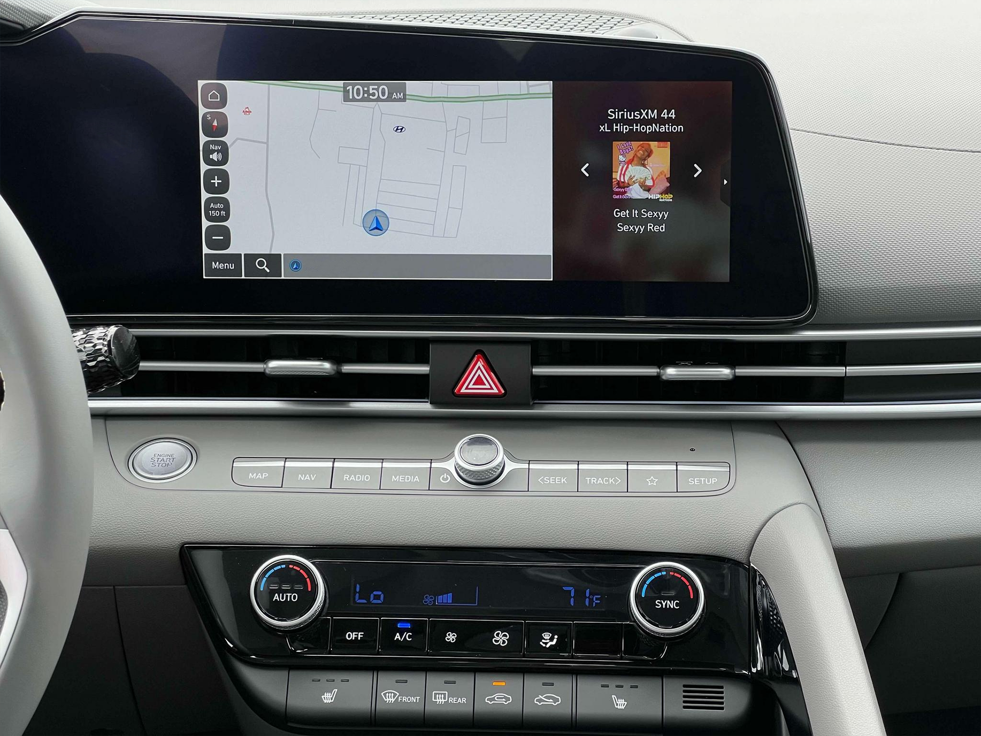 2024 Hyundai ELANTRA SEL Convenience